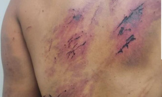 Violentada há anos, mulher consegue buscar a polícia após sessão de tortura do próprio marido