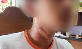 Cabo de internet suspenso na rua derruba motociclista e quase degola adolescente