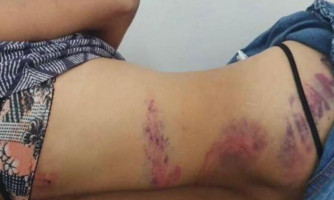 Em Vila Bela, mulher é brutalmente espancada dentro de carro e é resgatada seminua