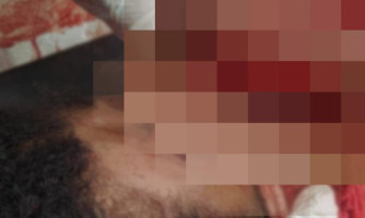 Mulher tem parte da orelha arrancada com golpe de facão durante briga em Pontes e Lacerda