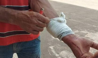 Por causa de R$ 10 padrasto é agredido por enteado, em Pontes e Lacerda
