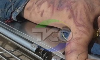 Suspeitos de espancar jovem são detidos pela Polícia Militar