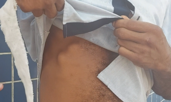 Tentativa de homicídio: homem é atacado com faca e pedras por casal usuários de drogas em Pontes e Lacerda