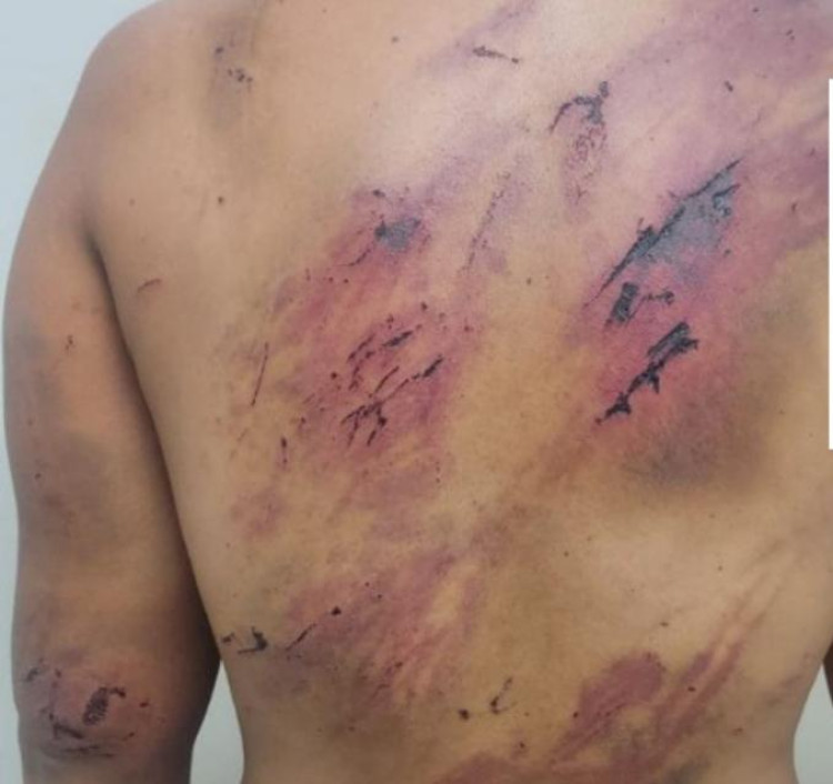 Violentada há anos, mulher consegue buscar a polícia após sessão de tortura do próprio marido