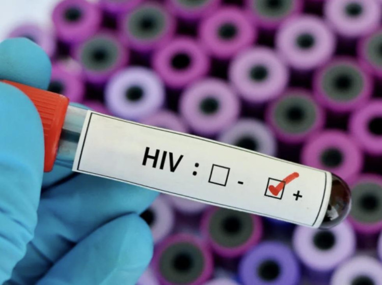 MT registra 316 novos casos de Aids entre janeiro e outubro de 2024