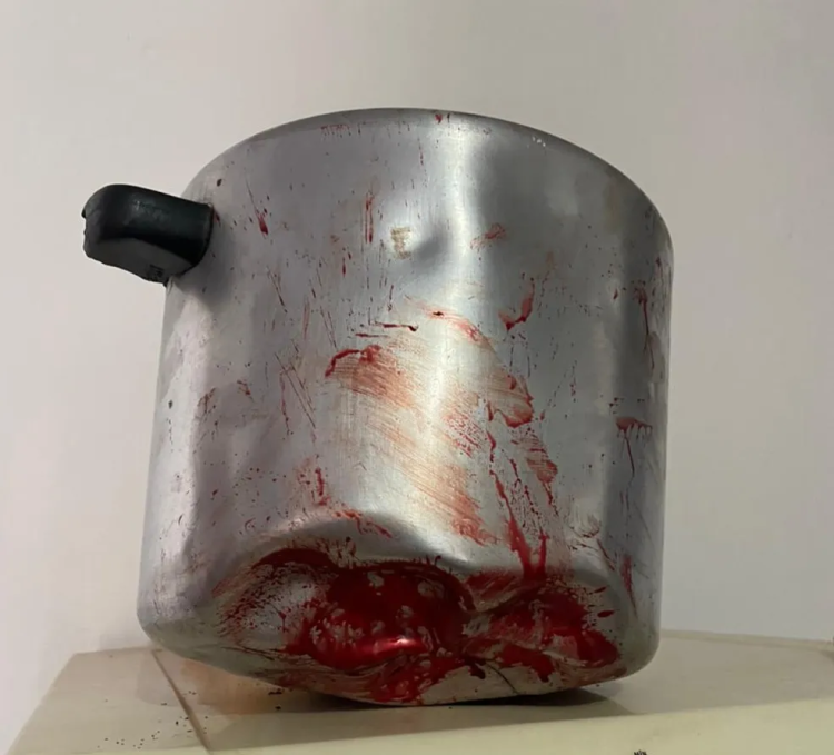 Adolescente é agredido ao tentar defender a mãe em caso de violência doméstica em São José dos Quatro Marcos