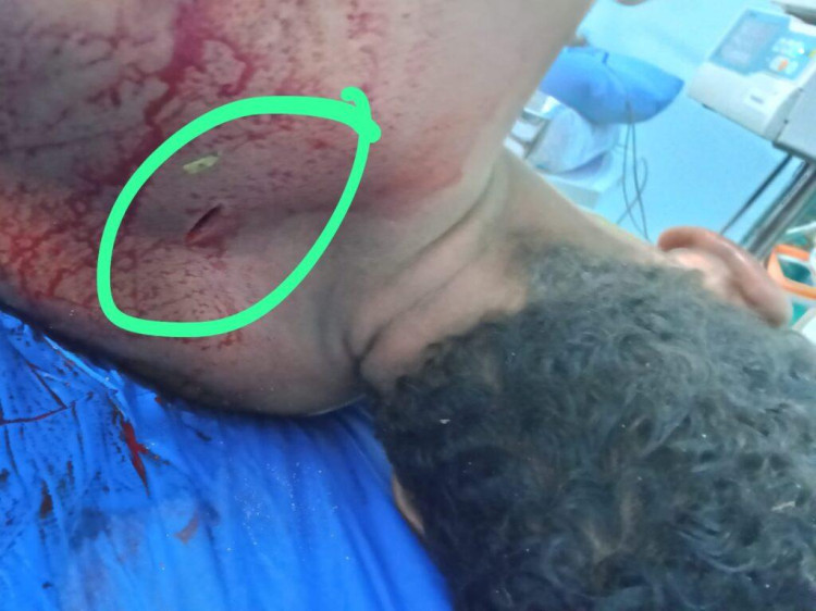 Homem acusado de estupro é espancado e levado ao hospital em Pontes e Lacerda