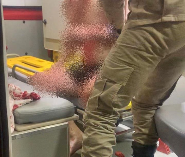 Ao tentar roubar residência, bandido se assusta e atira contra vítima