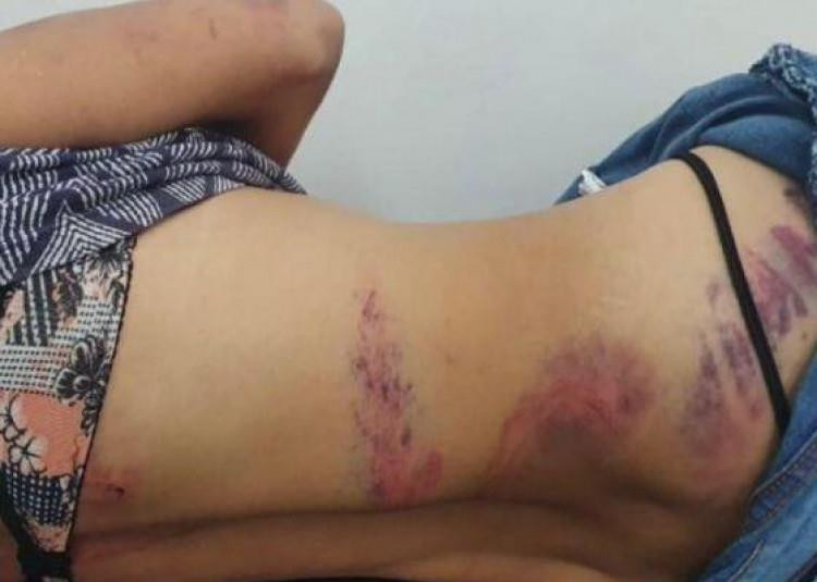 Em Vila Bela, mulher é brutalmente espancada dentro de carro e é resgatada seminua