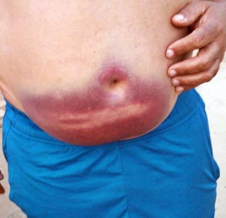 Homem é espancado por bandidos que tentavam roubar caminhonete no Córrego da Onça