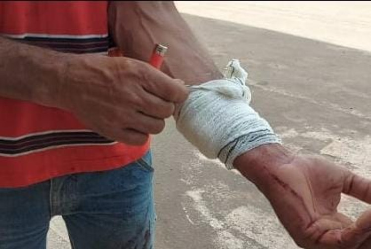 Por causa de R$ 10 padrasto é agredido por enteado, em Pontes e Lacerda