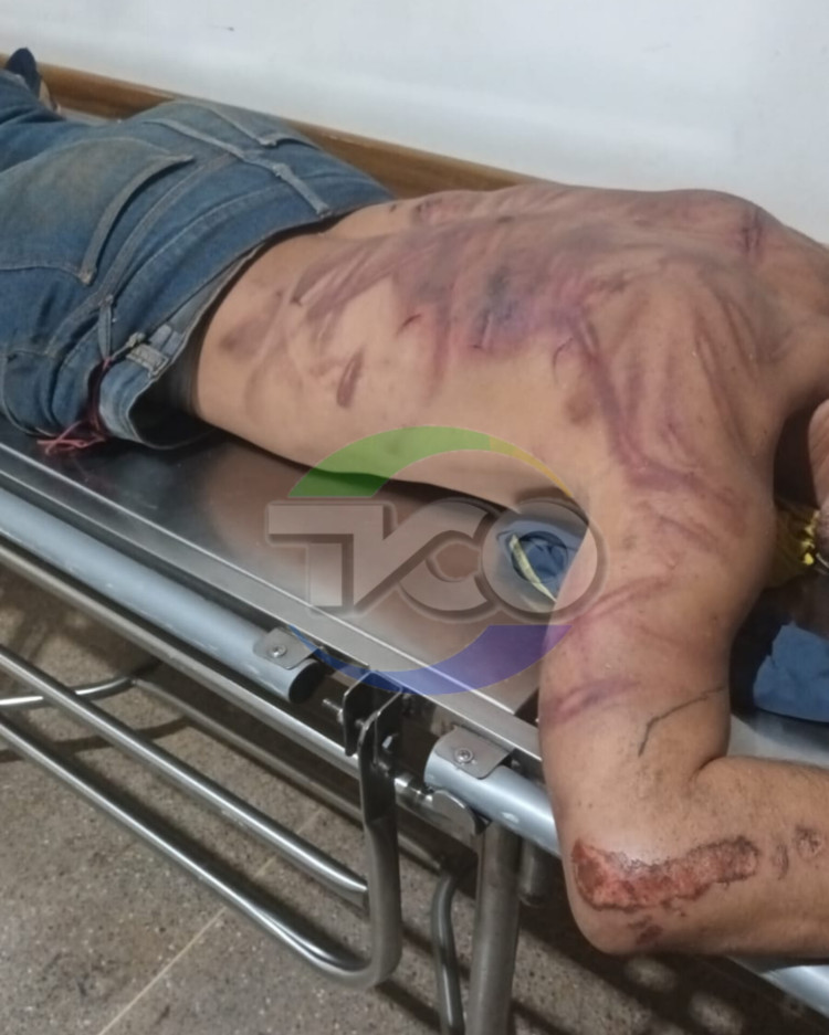 Suspeitos de espancar jovem são detidos pela Polícia Militar
