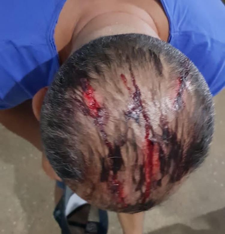 Vítima de assédio sexual contrata menores para se vingar de suspeito em Pontes e Lacerda